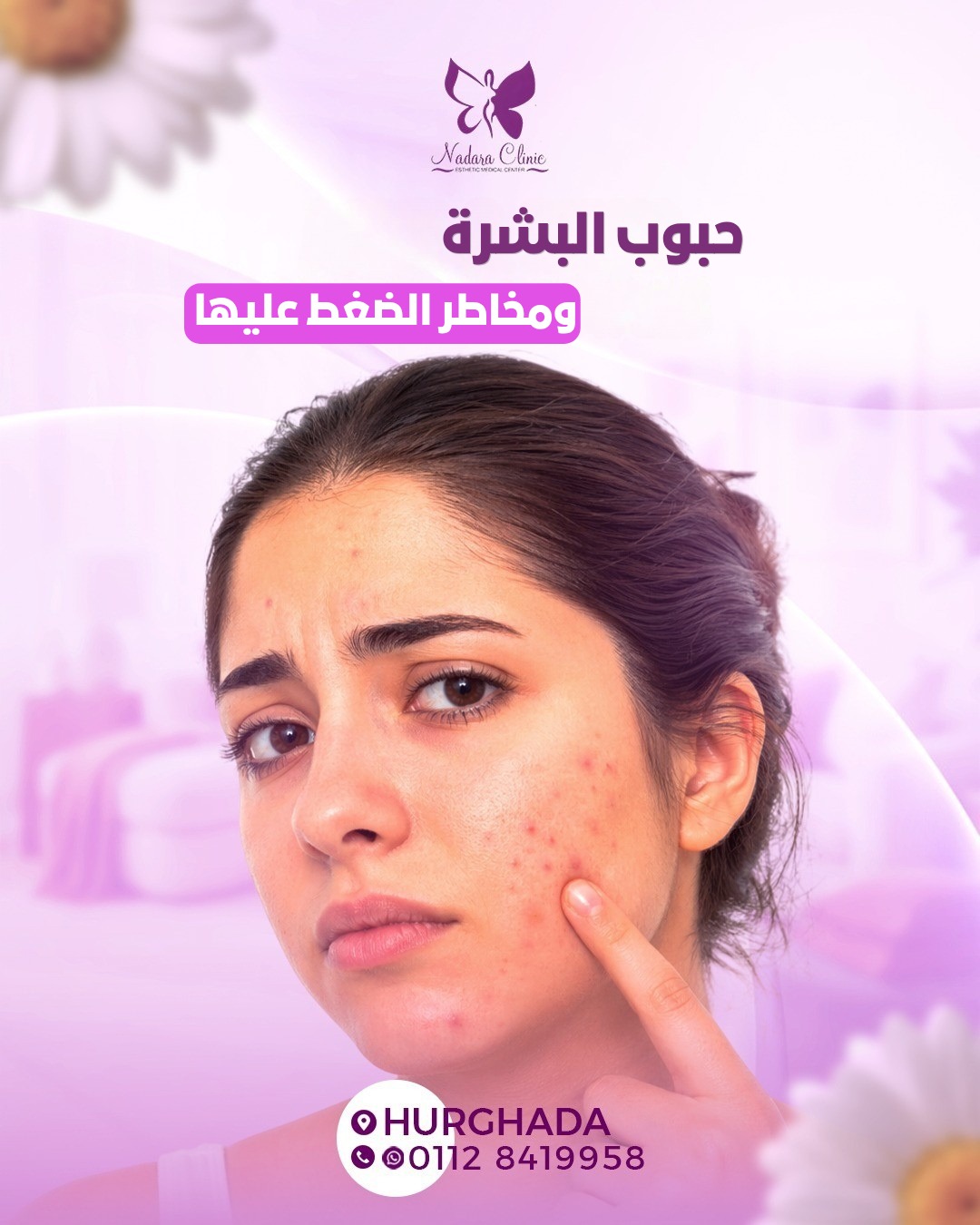 حبوب البشرة ومخاطر الضغط عليها في الغردقة